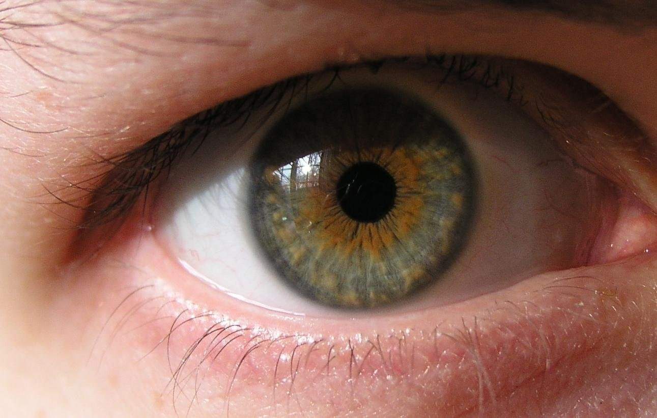 Цвет глаз хамелеон гетерохромия
