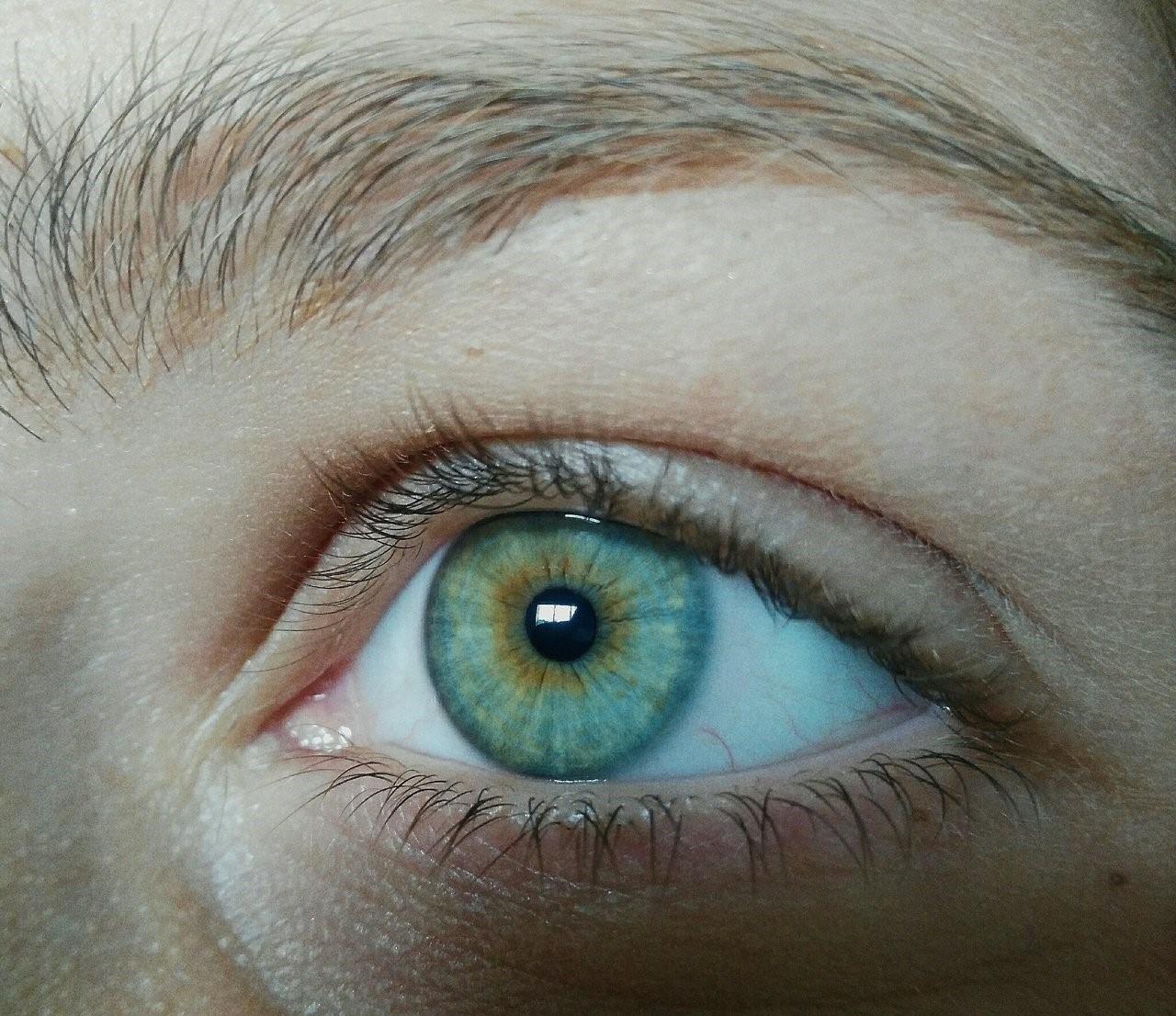 Почему глаза стали голубые. Центральная гетерохромия хамелеон. Центральная гетерохромия глаз Карий и зеленый. Гетерохромия Радужки. Центральная гетерохромия карих глаз.