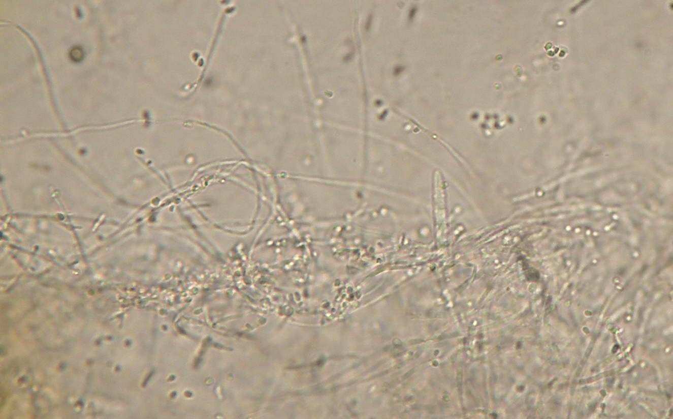 Нити мицелия споры. Микроспория микроскопия. Нити мицелия под микроскопом. Микроспорум Канис грибок.
